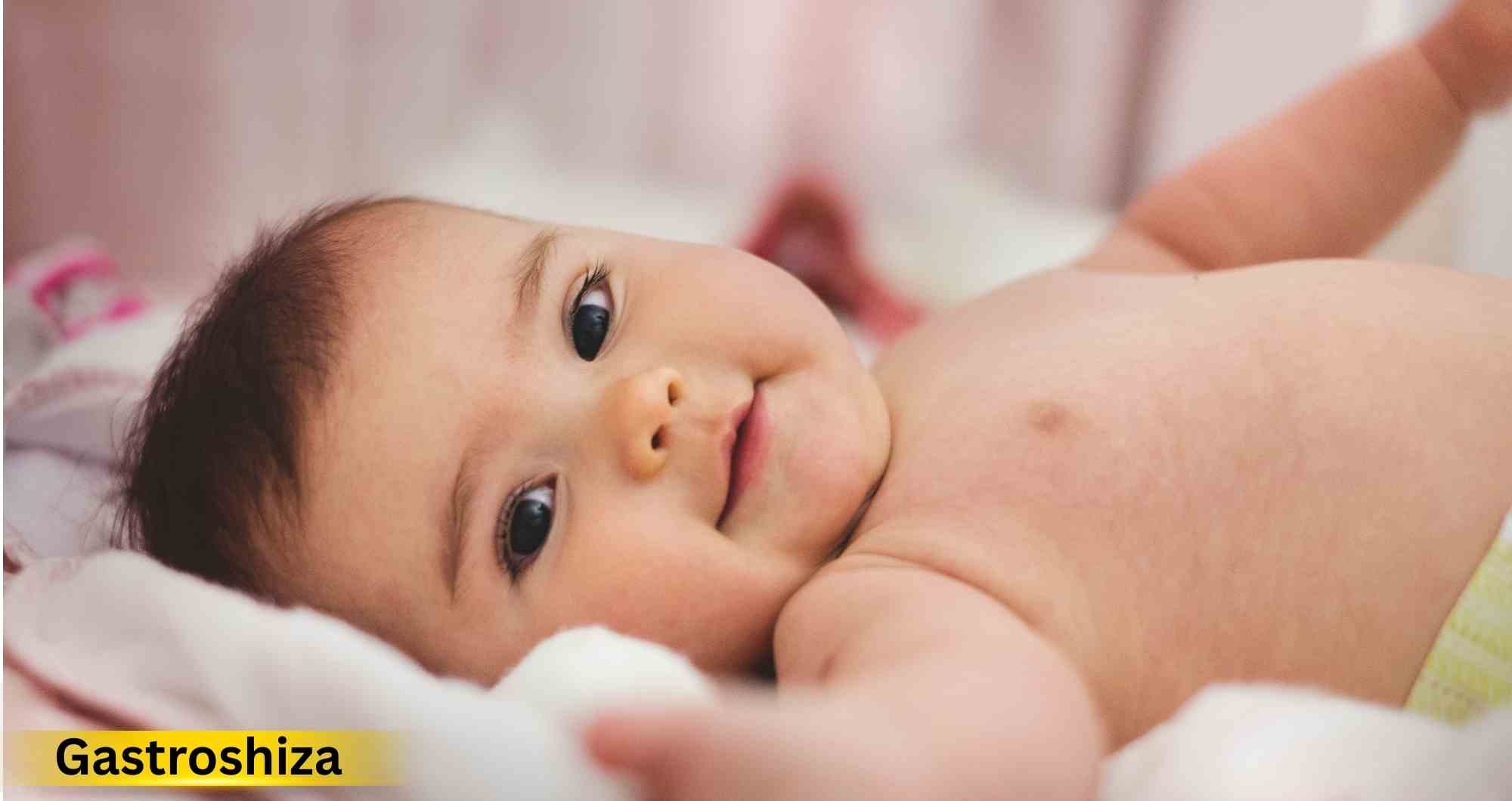 Gastroshiza: Causes, Symptoms, and Treatment Options